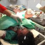 दुःखद: जंगल की आग पहुंची घर तक, बुझाने के प्रयास मे महिला झुलसी…