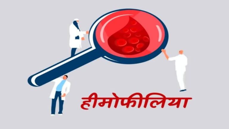स्वास्थ्य सचिव डॉ आर राजेश कुमार से सीएम धामी ने ली ये जानकारी, दिए ये निर्देश…