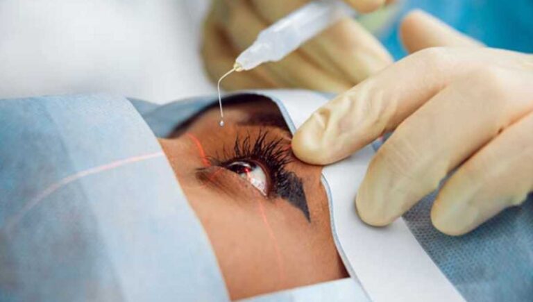 जुलाई माह में होंगे 09 निःशुल्क मोतियाबिंद शिविर